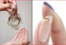 NE MOŽETE SPAVATI, IMATE LOMLJIVE NOKTE ILI VAM KOSA OPADA: Evo šta vam tijelo traži