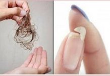 Ne možete spavati, nokti su vam krhki ili vam opada kosa: ovo vaše tijelo traži