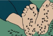 Bole li vas noge i osjećate li se kao da “mravi hodaju” po njima, VAŽAN SIGNAL KOJI NIKAKO NE SMIJETE ZANEMARITI!