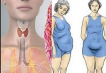 Štitnjača igra ključnu ulogu u regulaciji hormona i održavanju zdrave težine, bilo da se radi o pretjeranoj mršavosti ili debljini.