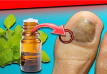 Gljivice i infekcija noktiju NESTAJU za 24 sata: V0lio bih da sam znao za ovo ranije!