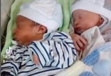 RODILA BLIZANCE, PA ZANEMELA OD ŠOKA: Lekari trčali da ih vide, otac mislio da je greška, sad imaju 5 godina i ČUDNI SU