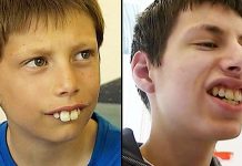 Dečak kojem su se rugali zbog zuba danas se ponosno smeje – priča o hrabrosti, upornosti i dobroti ljudi