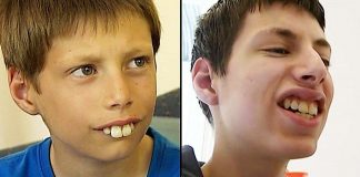 Dečak kojem su se rugali zbog zuba danas se ponosno smeje – priča o hrabrosti, upornosti i dobroti ljudi