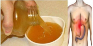 KISELINA SA ŽELUCA ME GUŠILA DANIMA SVE DOK MI PRIJATELJICA NIJE DALA DA OVO POPIJEM