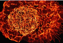 8 namirnica za doručak koje mogu pomoći u smanjenju upalnih procesa u tijelu