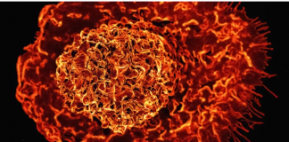 8 namirnica za doručak koje mogu pomoći u smanjenju upalnih procesa u tijelu