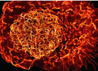 8 namirnica za doručak koje mogu pomoći u smanjenju upalnih procesa u tijelu