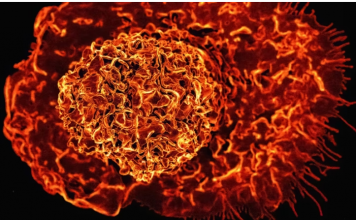 8 namirnica za doručak koje mogu pomoći u smanjenju upalnih procesa u tijelu