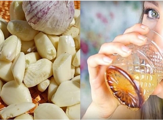 Čuvar vašeg srca, mozga i bubrega: Očistite arterije snažnim napitkom koji poboljšava cirkulaciju i smanjuje krvni pritisak