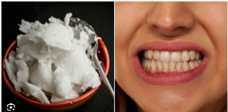 Kokosovo ulje u oralnoj higijeni: prirodna navika kao dodatak svakodnevnoj njezinoj higijeni