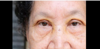 VOĆKA BROJ 1 PROTIV HOLESTEROLA, PRITISKA I MOŽDANOG UDARA: Ko jede zdravlje je tu…