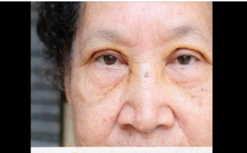 VOĆKA BROJ 1 PROTIV HOLESTEROLA, PRITISKA I MOŽDANOG UDARA: Ko jede zdravlje je tu…