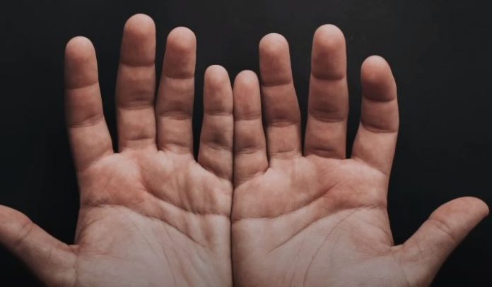 Ove linije na dlanu imaju samo posebni ljudi, nema ih mnogo, iznenadićete se kada čujete šta znače - featured image Ove linije na dlanu imaju samo posebni ljudi, nema ih mnogo, iznenadićete se kada čujete šta znače - featured image
